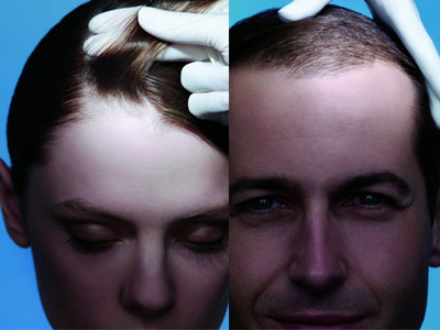 Φροντίδα κατά της τριχόπτωσης με το Kerium anti-shupe champoo